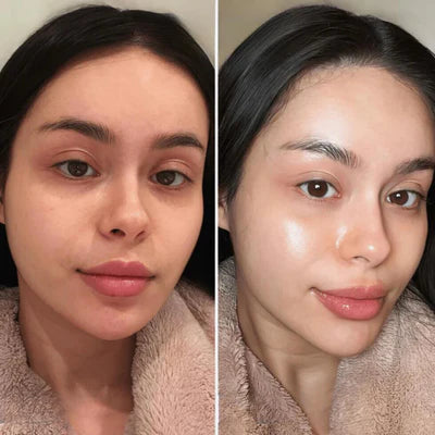 Age R Booster Pro Massageador facial EMS medicube para sua pele e rosto pele koreano korea coreano radiante lançamento frete gratis loja deepbel